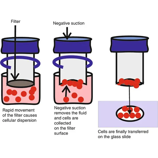 liquid based cytology test